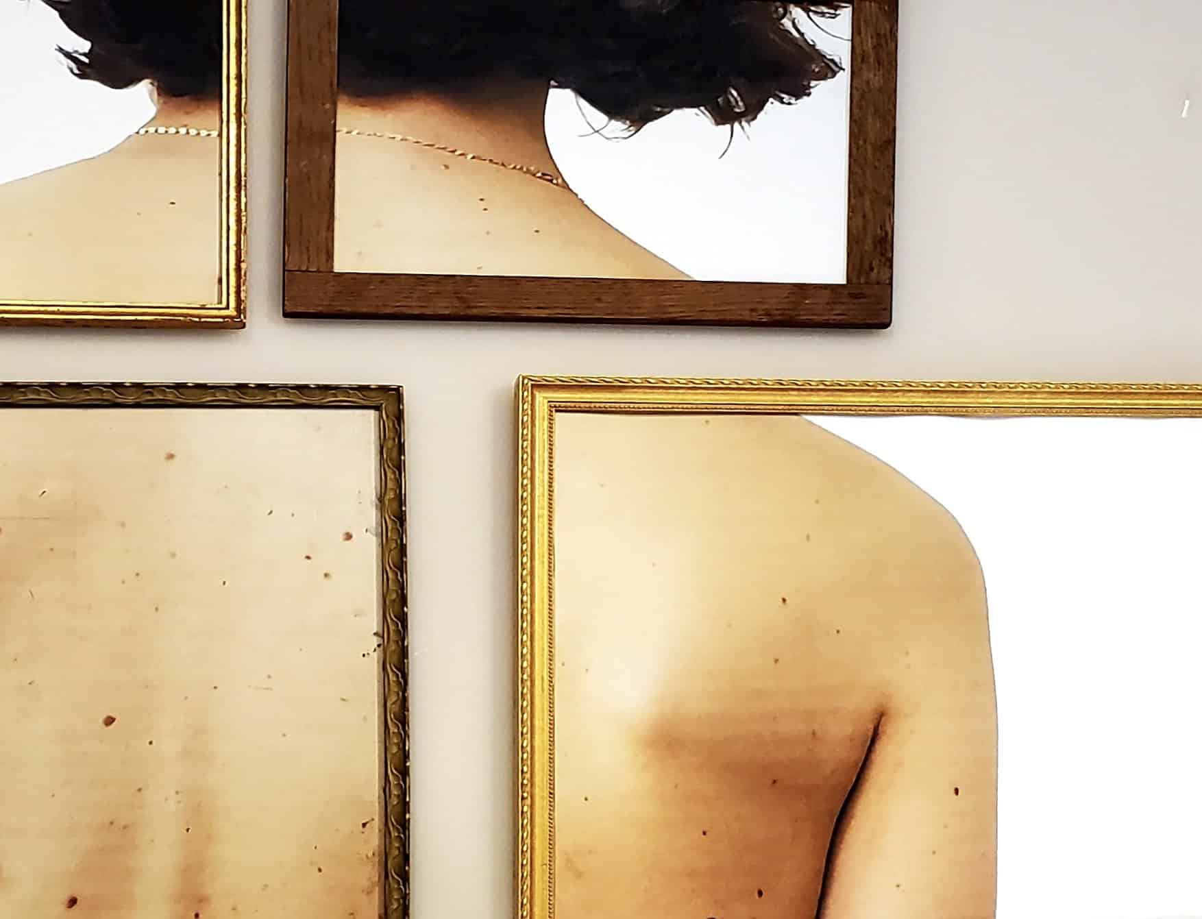 Three framed photographs show close-up views of a person’s bare back and neck against a white background, each image capturing different angles and sections of the skin and shoulders.